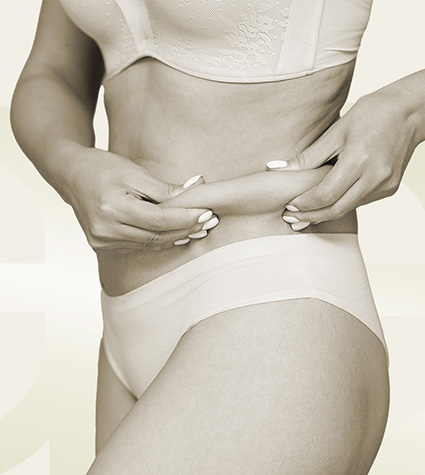 Weiblicher Körper mit überschüssiger Haut symbolisiert Hautstraffung mit Argon Plasma in Tübingen