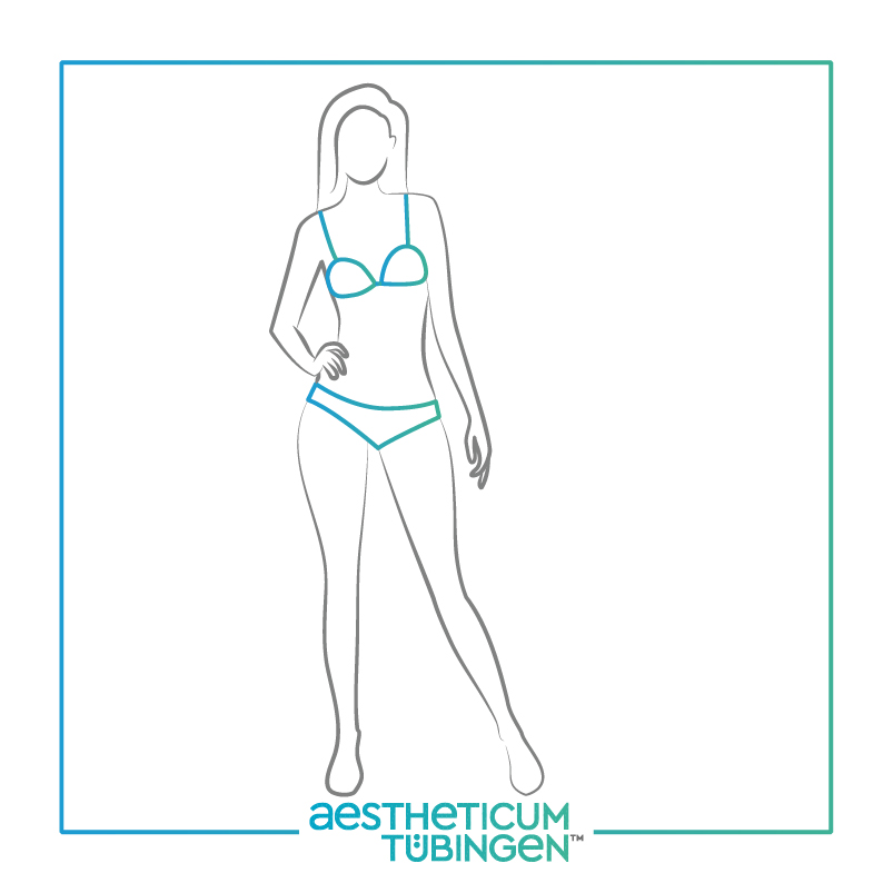 Lipödem OP bei Stuttgart: Darstellung nachher zeigt einen schlanken Körper