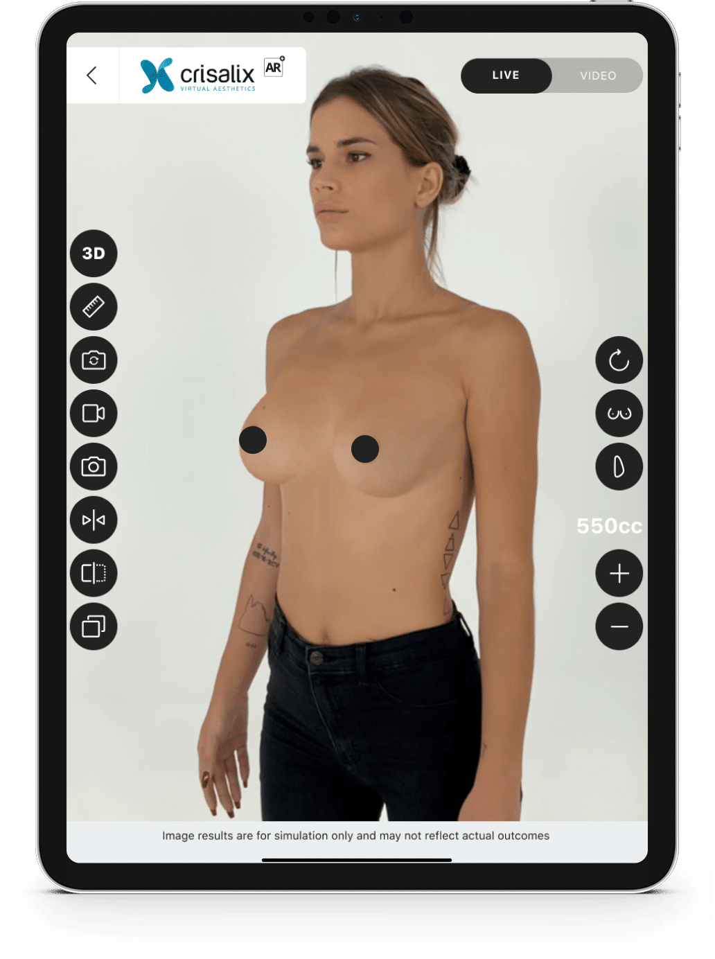 Brustvergrößerung 3D-Simulation