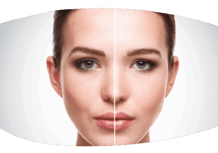 Vorher-Nachher-Bilder – was bedeutet das für euch?