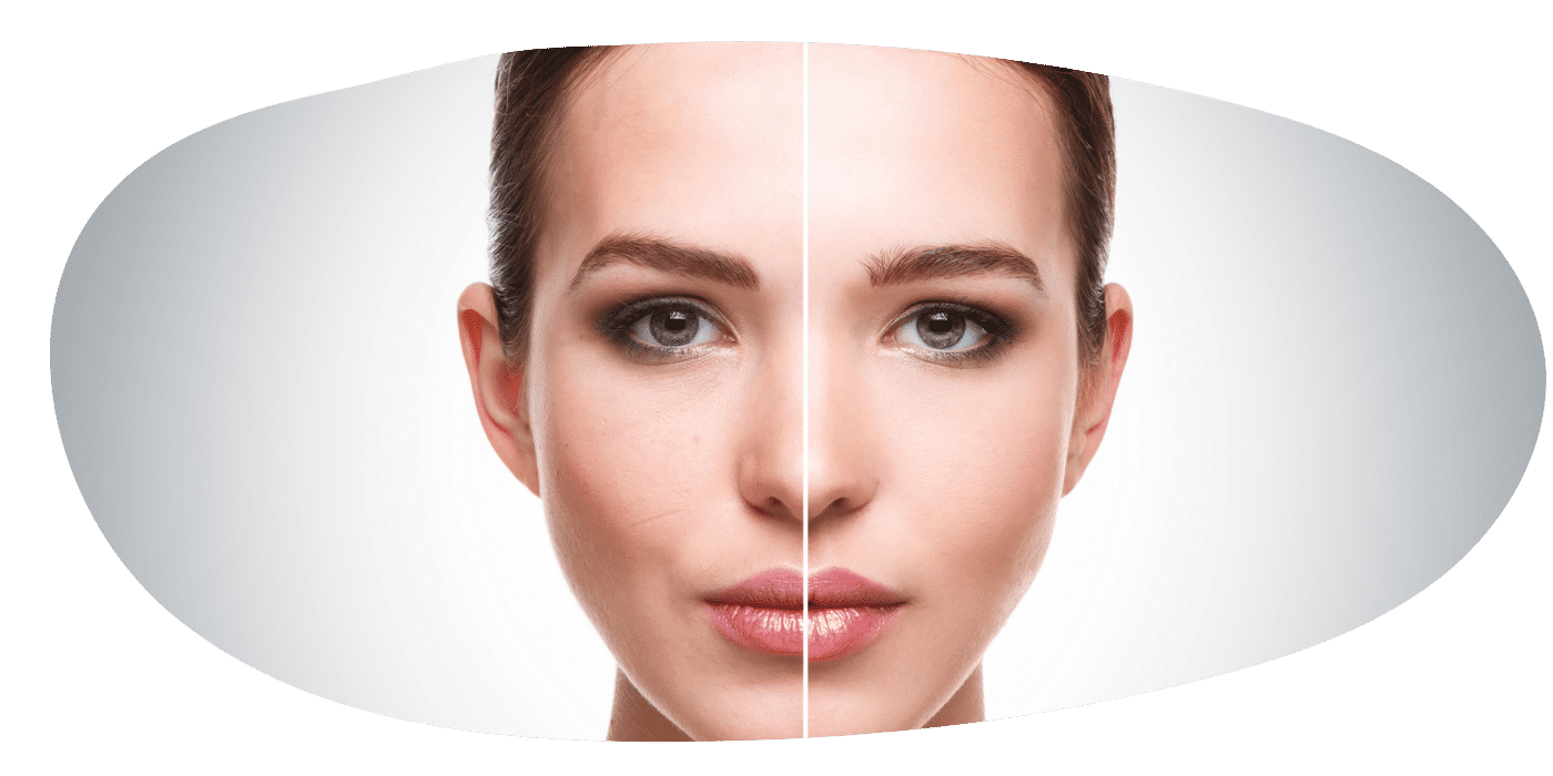 Vorher-Nachher-Bilder – was bedeutet das für euch?